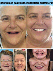 Full Denture Set